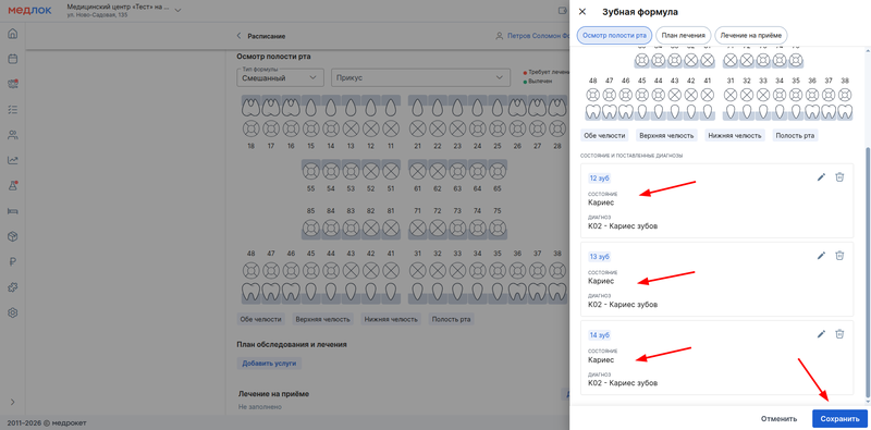 добавили диагнозы для зубов