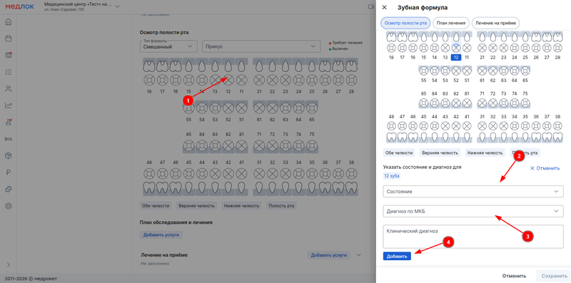 внесение состояния зуба